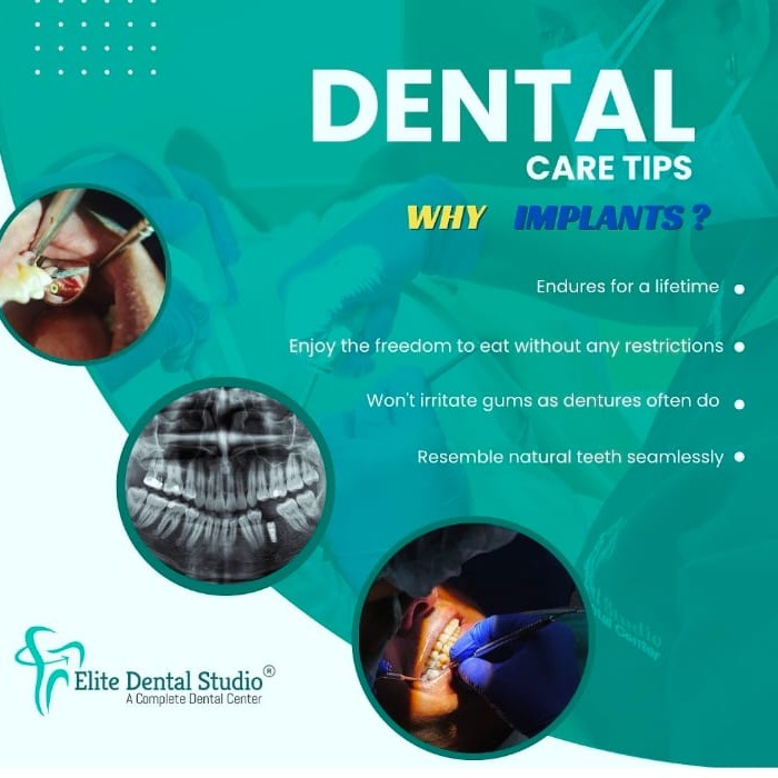 Dental Clinic  Talap Kannur, Dental Doctor   Talap Kannur, Dental Hospital Talap Kannur ,Elite Dental Studio