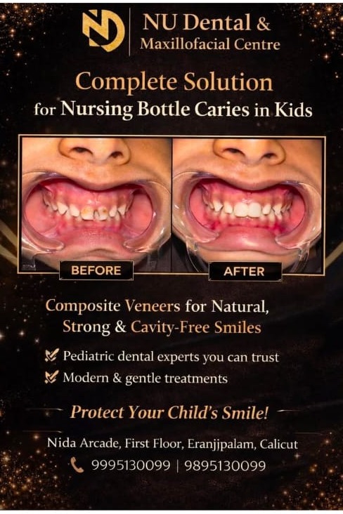 Dental Clinic Eranjipalam Calicut, Maxillofacial Centre Eranjipalam Calicut,Nu Dental & Maxillofacial Centre 
