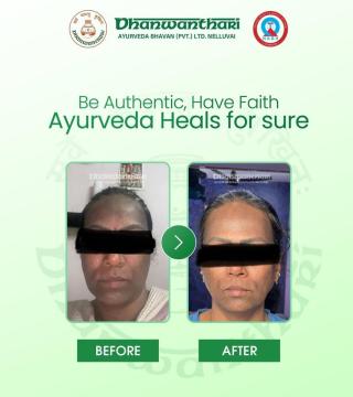 Ayurveda treatment Nelluvai Thrissur, Ayurveda clinic Nelluvai Thrissur, Holistic wellness Ayurveda Nelluvai Thrissur,  Dhanwanthari Ayurveda 