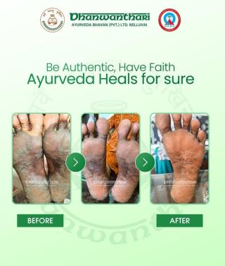 Ayurveda treatment Nelluvai Thrissur, Ayurveda clinic Nelluvai Thrissur, Holistic wellness Ayurveda Nelluvai Thrissur,  Dhanwanthari Ayurveda 