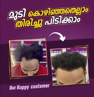Premium hair & Cosmetic Clinic Aranattukara Thrissur, ​Hair Transplantation Aranattukara Thrissur, GFC Treatment for Hair Loss Aranattukara Thrissur,Hair O world