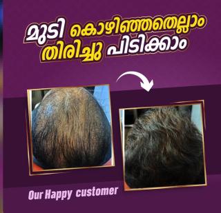 Premium hair & Cosmetic Clinic Aranattukara Thrissur, ​Hair Transplantation Aranattukara Thrissur, GFC Treatment for Hair Loss Aranattukara Thrissur,Hair O world