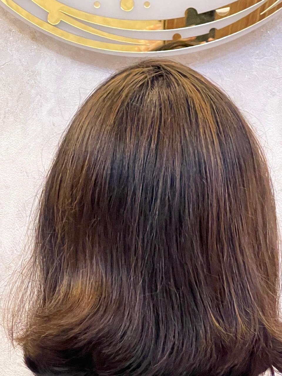 hair  treatment in thrissur 